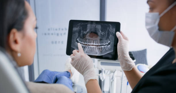 Licensed Teeth Whitening service in Augusta, GA - Smile Center Dentistry
